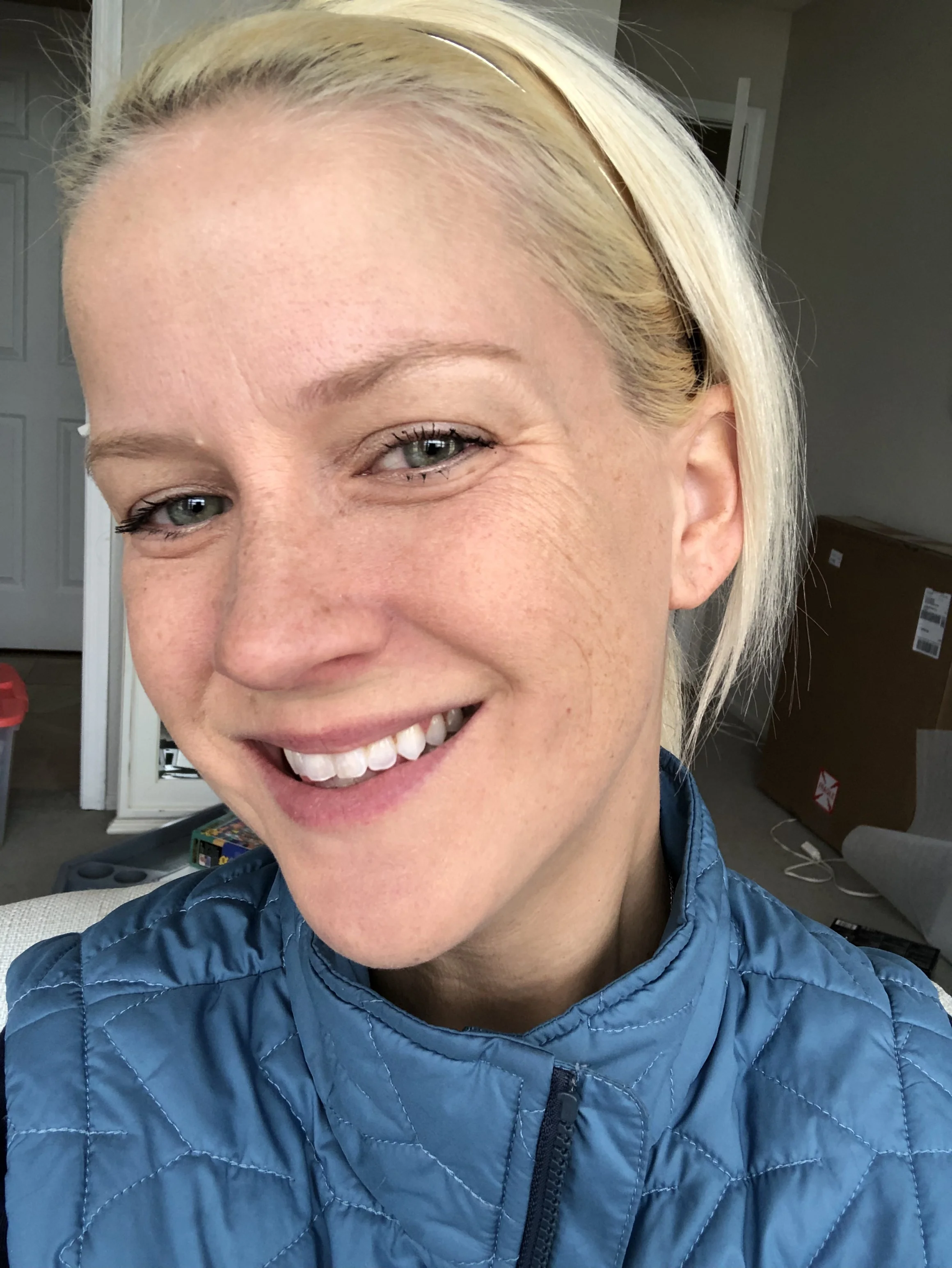 beautybio roller before pic.JPG