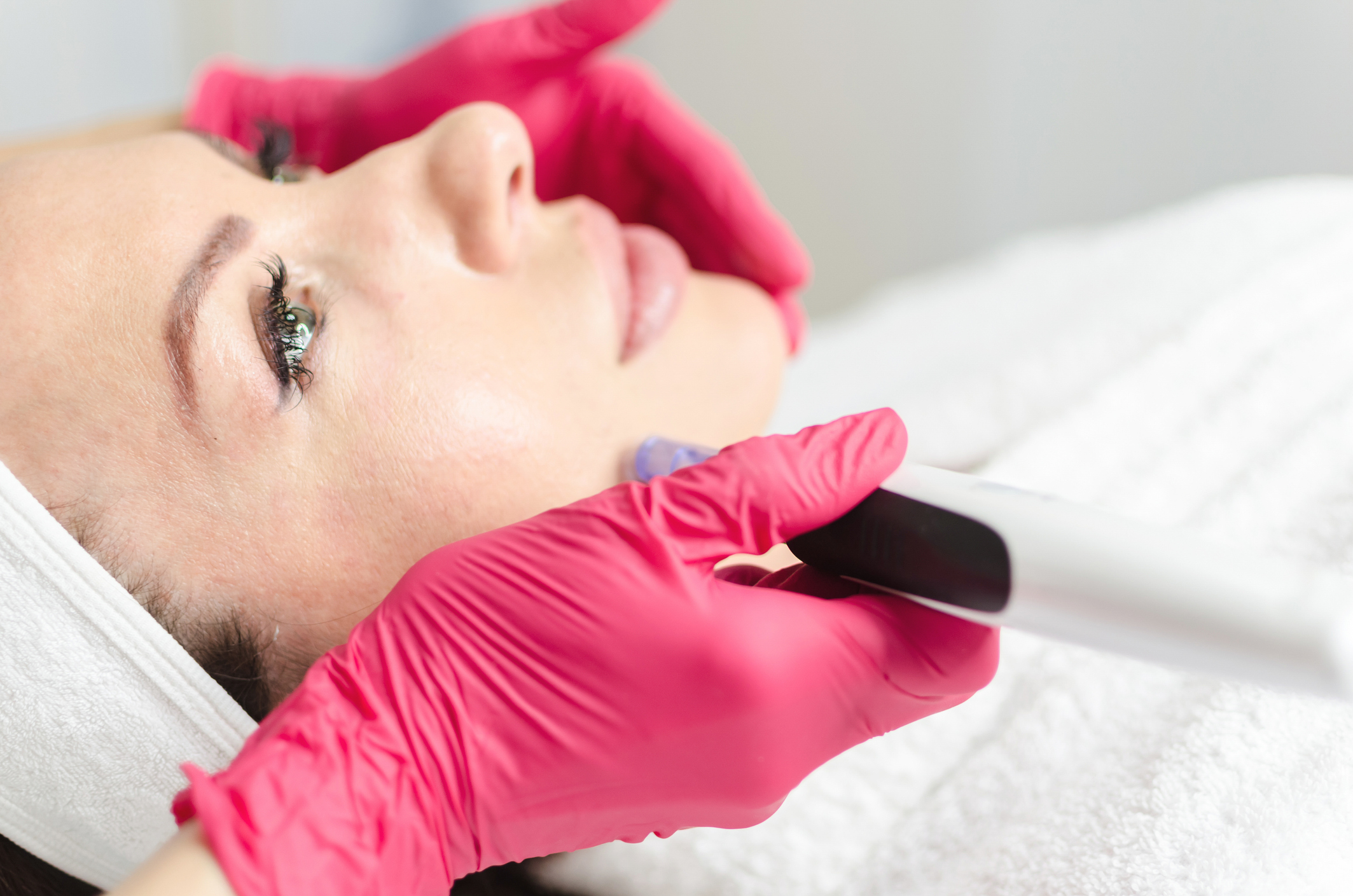 microneedling.jpeg