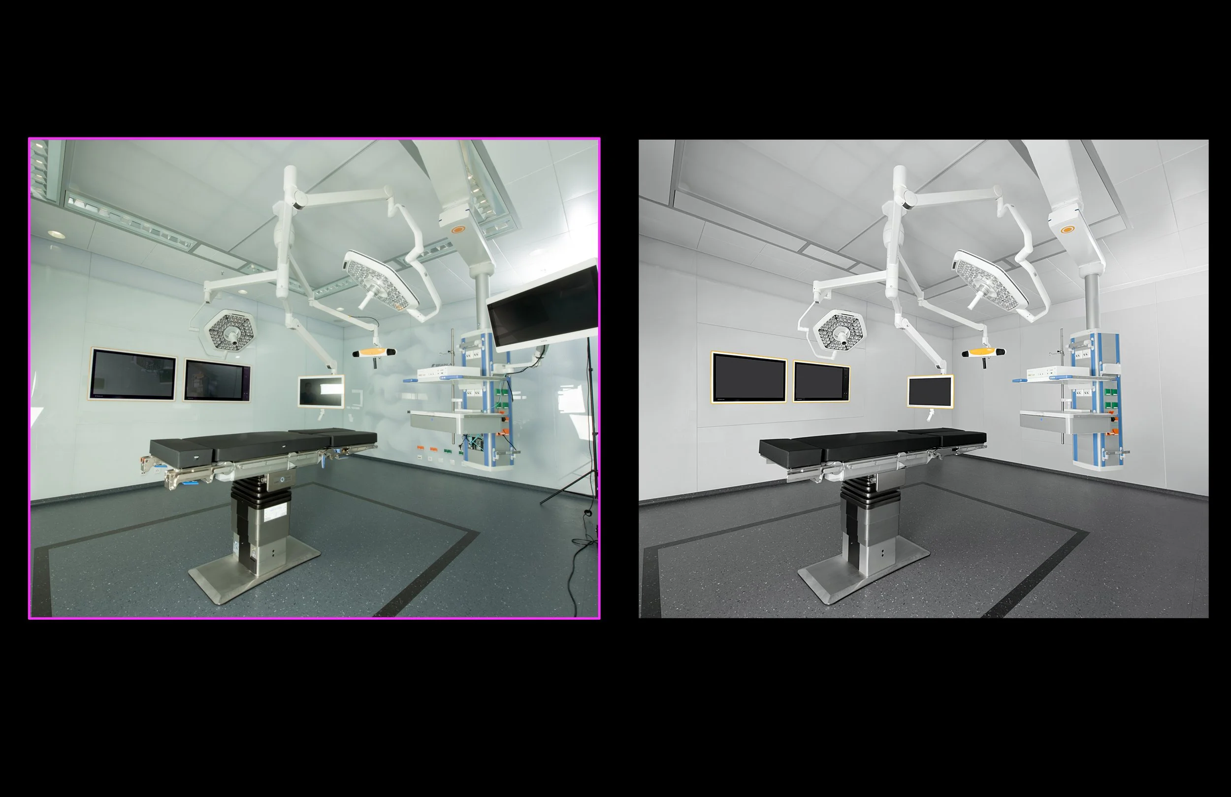 retouching_brainlab_or_k.jpg