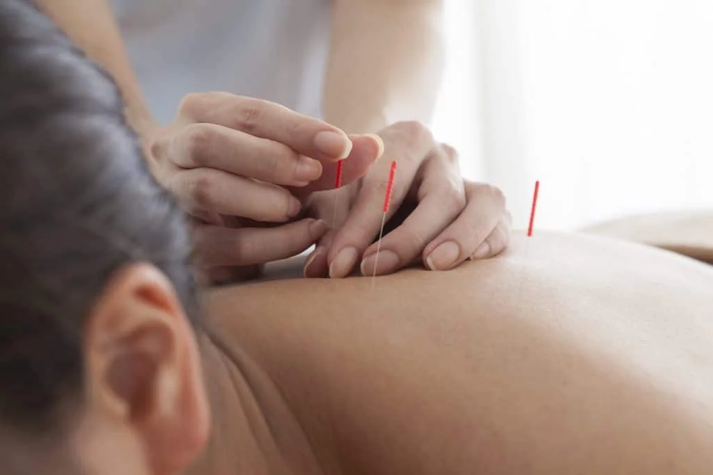 ACCUPUNCTURE-SHUTTER-1024x683.jpg