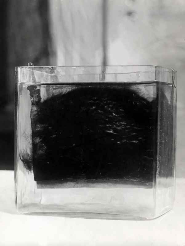 Een glazen bak met dierlijke haren die zogenaamd geïmplanteerd zullen worden, een wondermiddel tegen kaalhoofdigheid. 1938. A glass container with animal hair which allegedly will be implanted. A universal remedy against baldness, 1938.