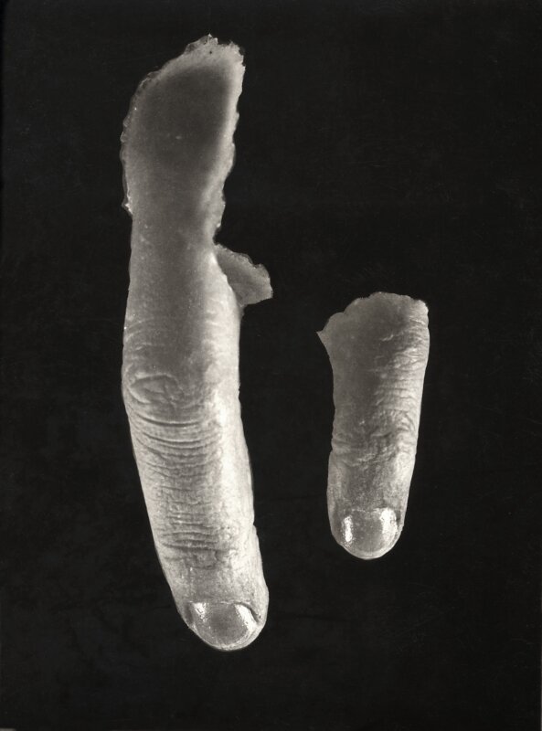  Vingervormige prothesen om op verminkte handen te zetten van professor Henning. Oostenrijk, 1937. 