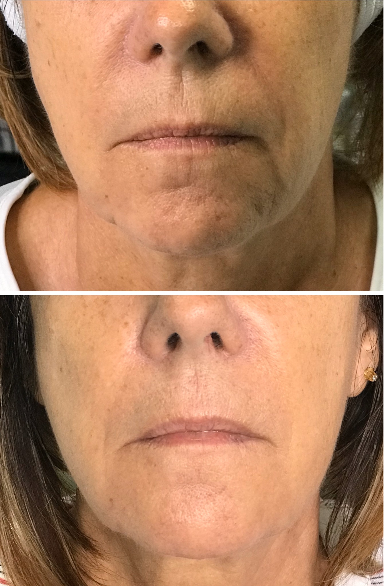 Ten (10) days post treatment.