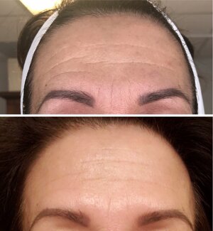 ilu anti aging maszk a célponton bare minerals anti aging szérum