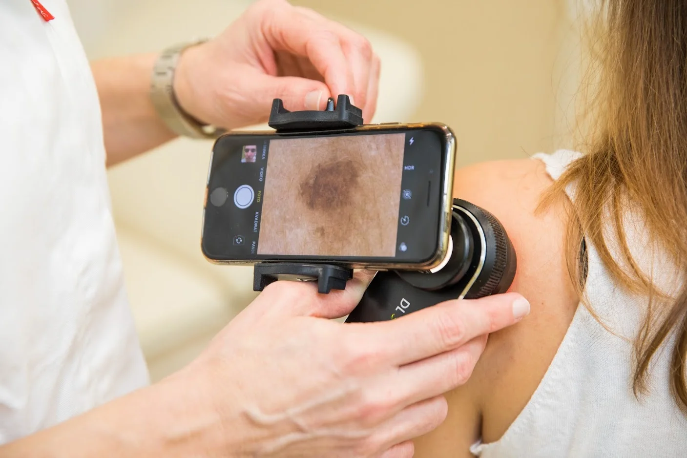 dermatoskopija.jpg