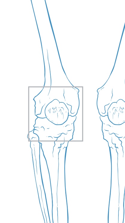 SURGICAL PROCEDURES & CONDITIONS OF THE KNEE