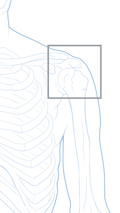 SHOULDER REPLACEMENT SURGERY