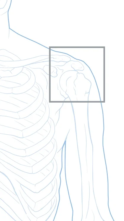 SURGICAL PROCEDURES & CONDITIONS OF THE SHOULDER