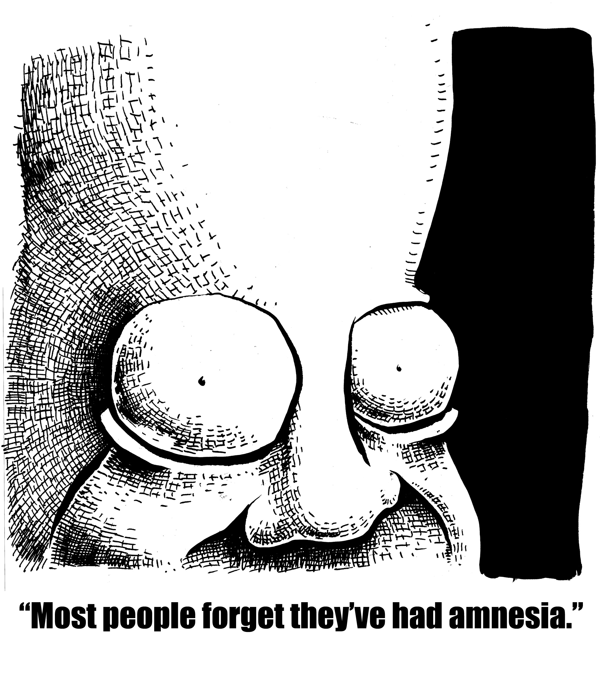 Most People Forget They've Had Amnesia