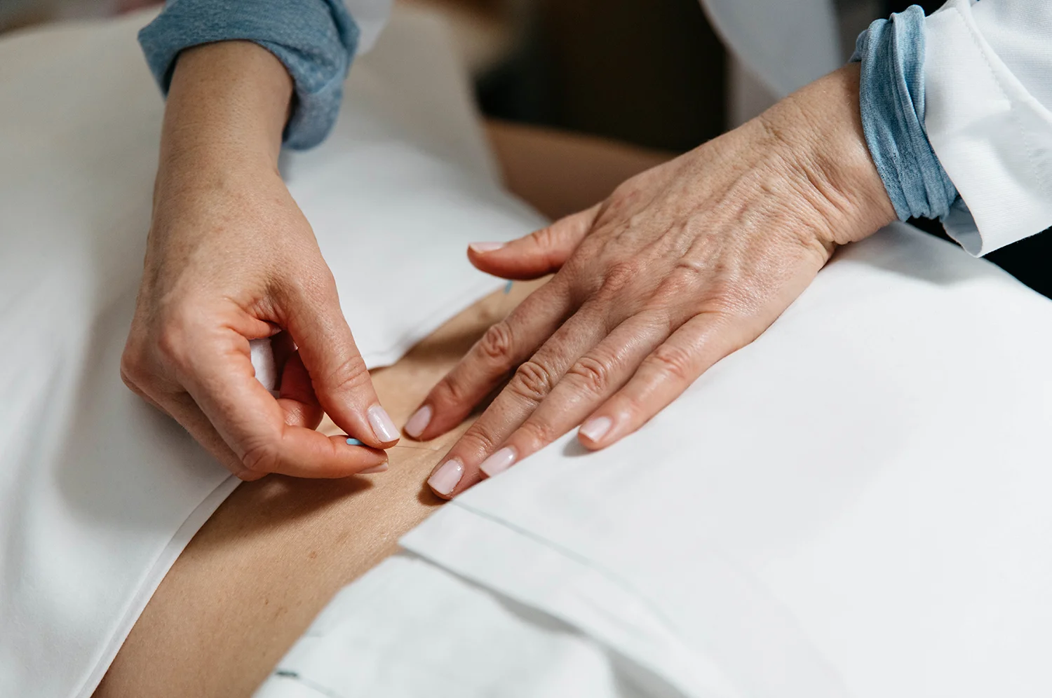 LBL Acupuncture 3.jpg