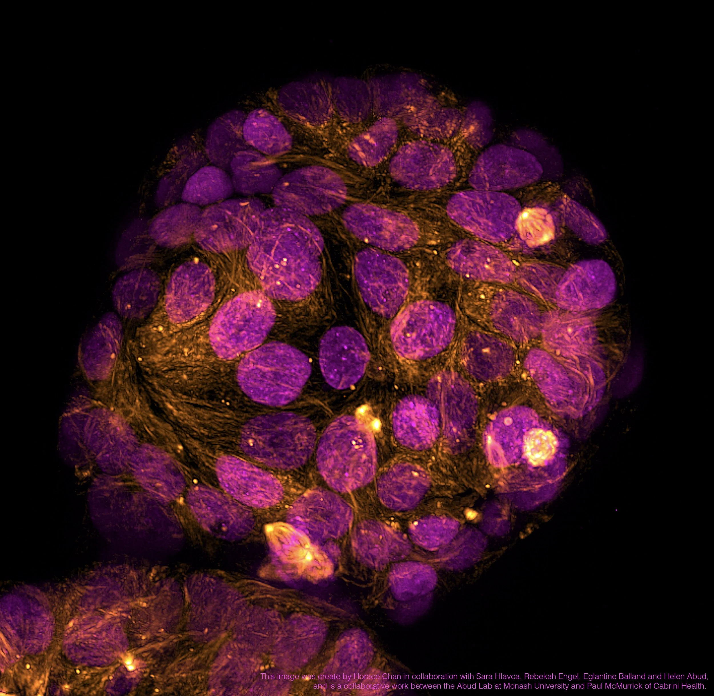 organoid_model.jpeg