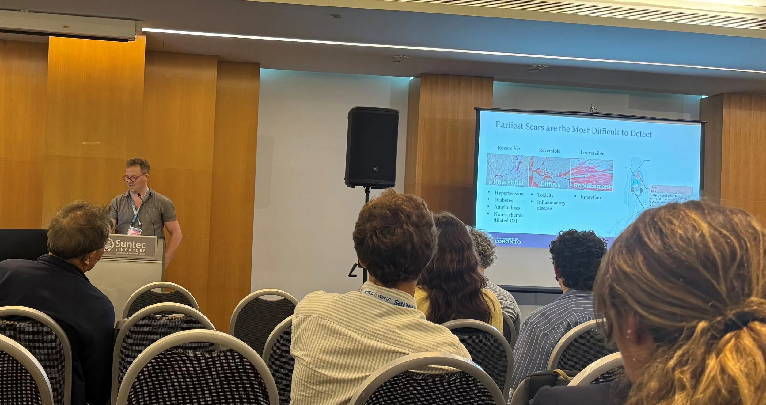 2024 ISMRM: Kyle Vollett