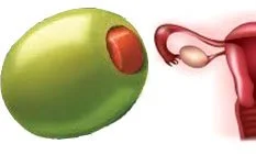 olive_ovary.jpg