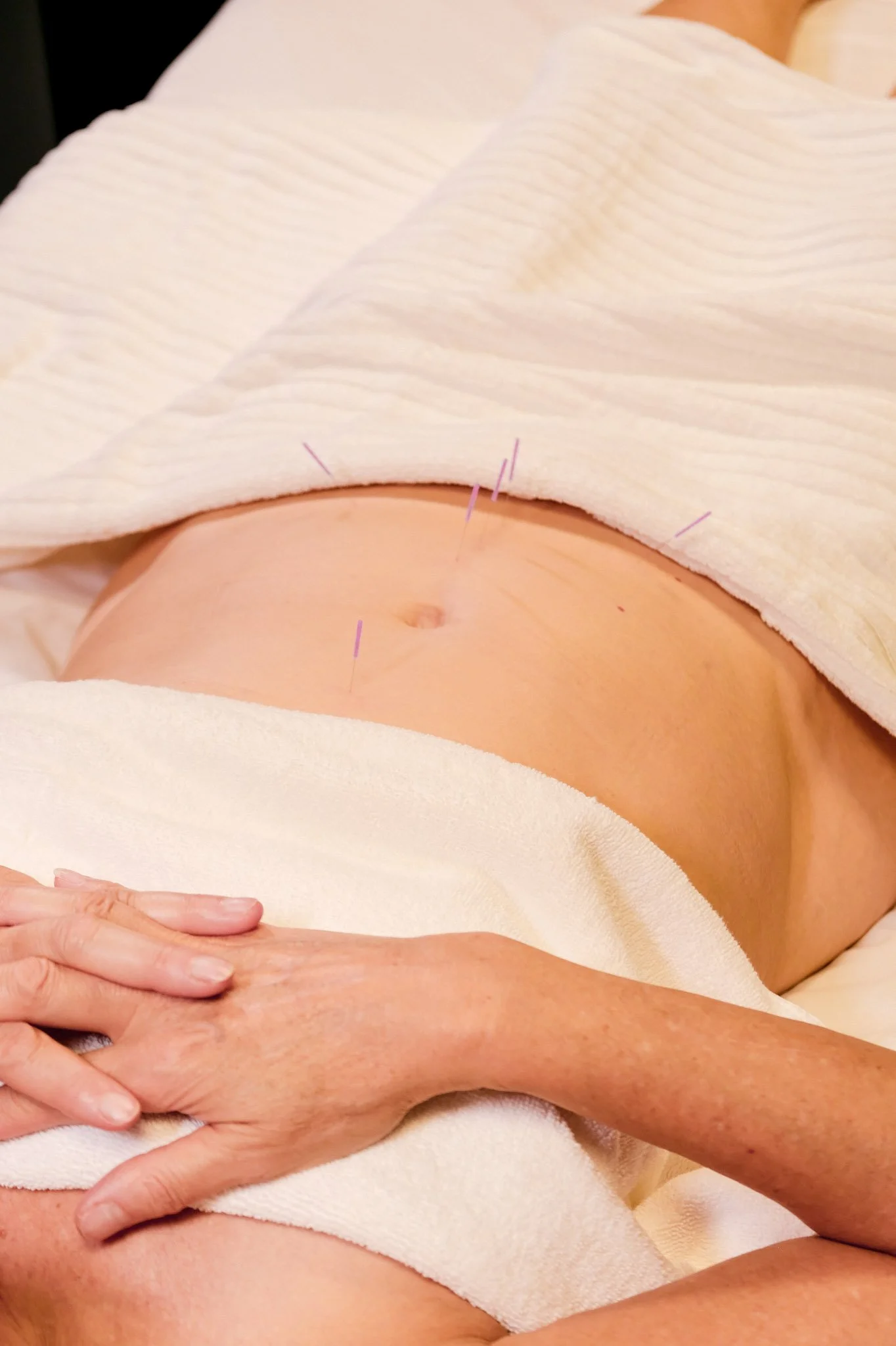 Enhancing Assisted Reproductive Technology (ART) with Acupuncture: A Comprehensive Guide to IVF and IUI Acupuncture Protocol