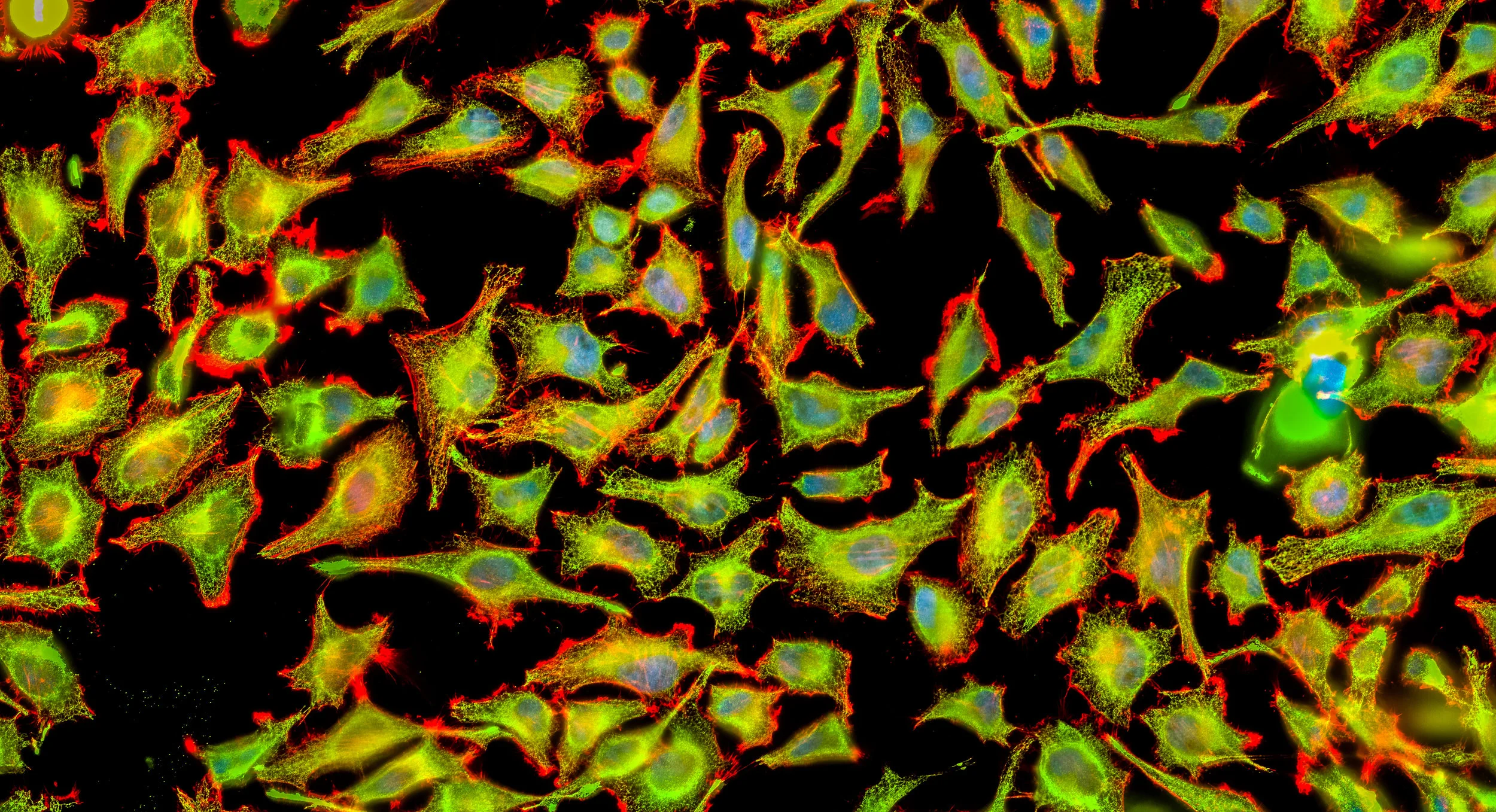 2018_02_05_Hela Mito ER RGB crop.jpg