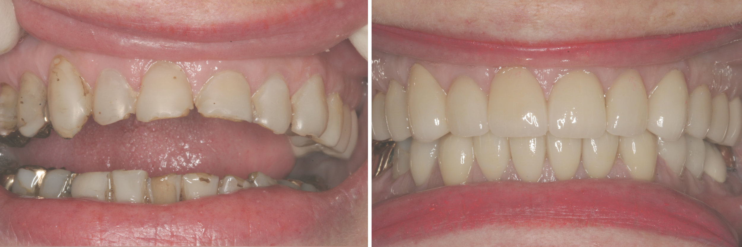 before_after12.jpg