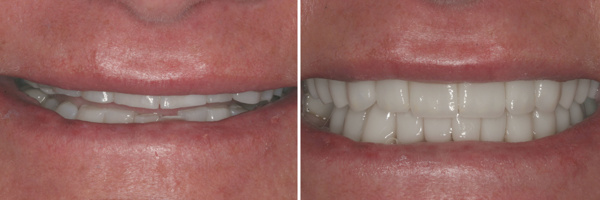 before_after19.jpg