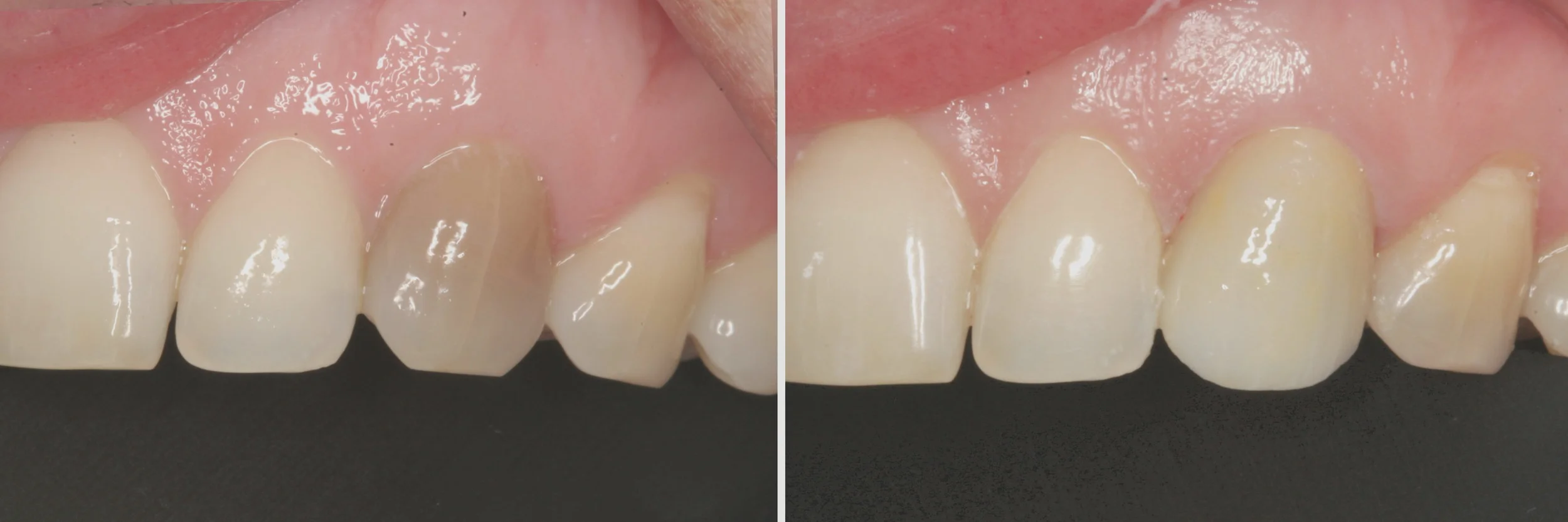 before_after18.jpg