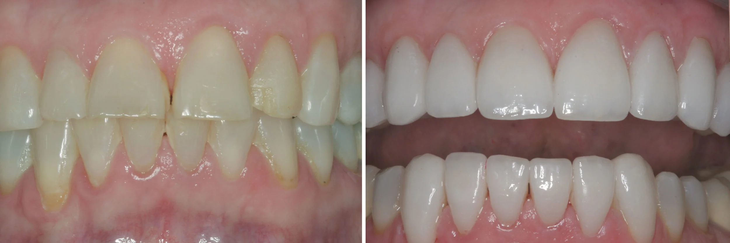 before_after25.jpg
