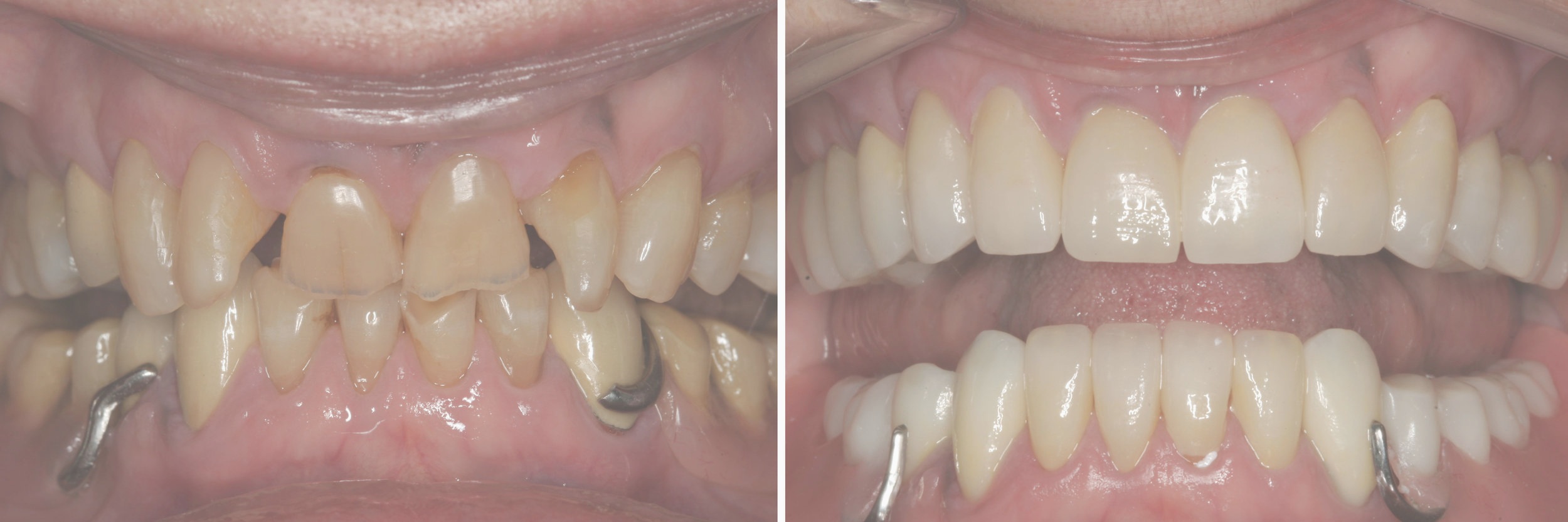 before_after10.jpg