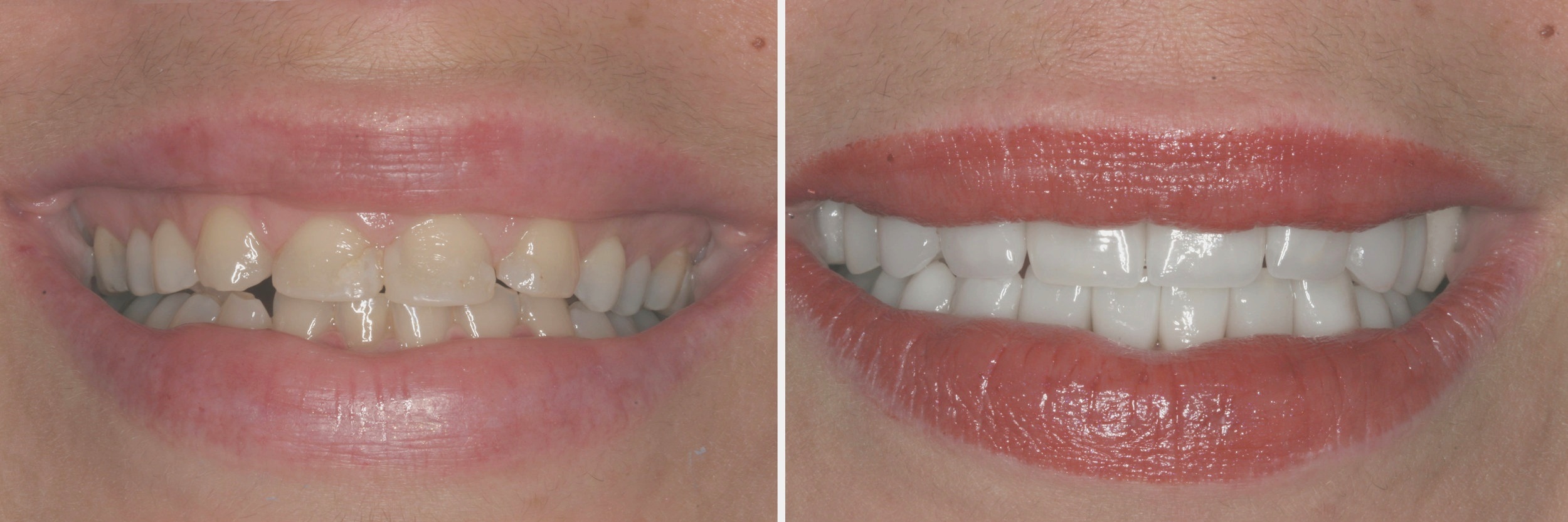 before_after30.jpg