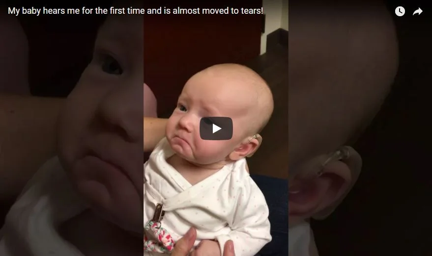 Baby Hears Mom For The First Time After Receiving Hearing Aids