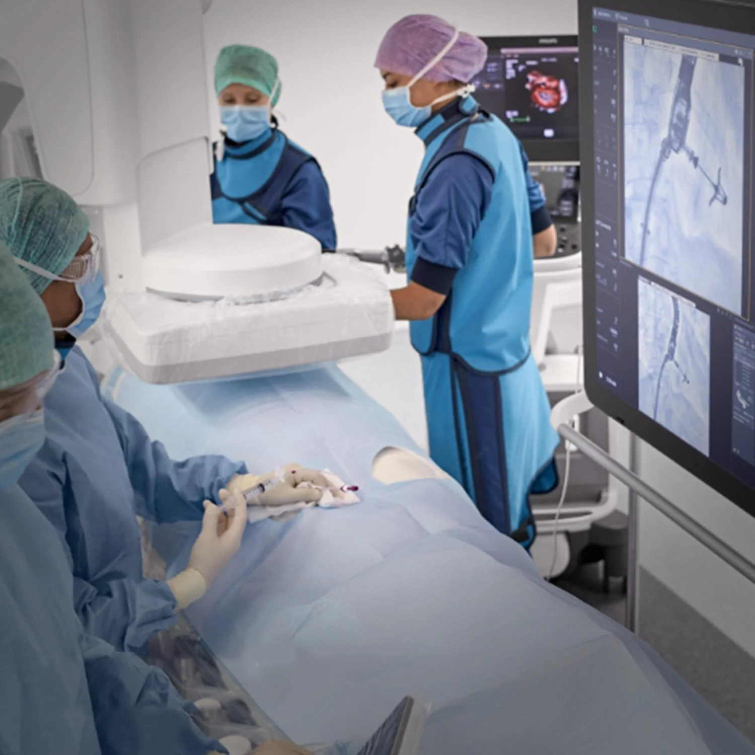 YSVOGEL | cardiac stent placement