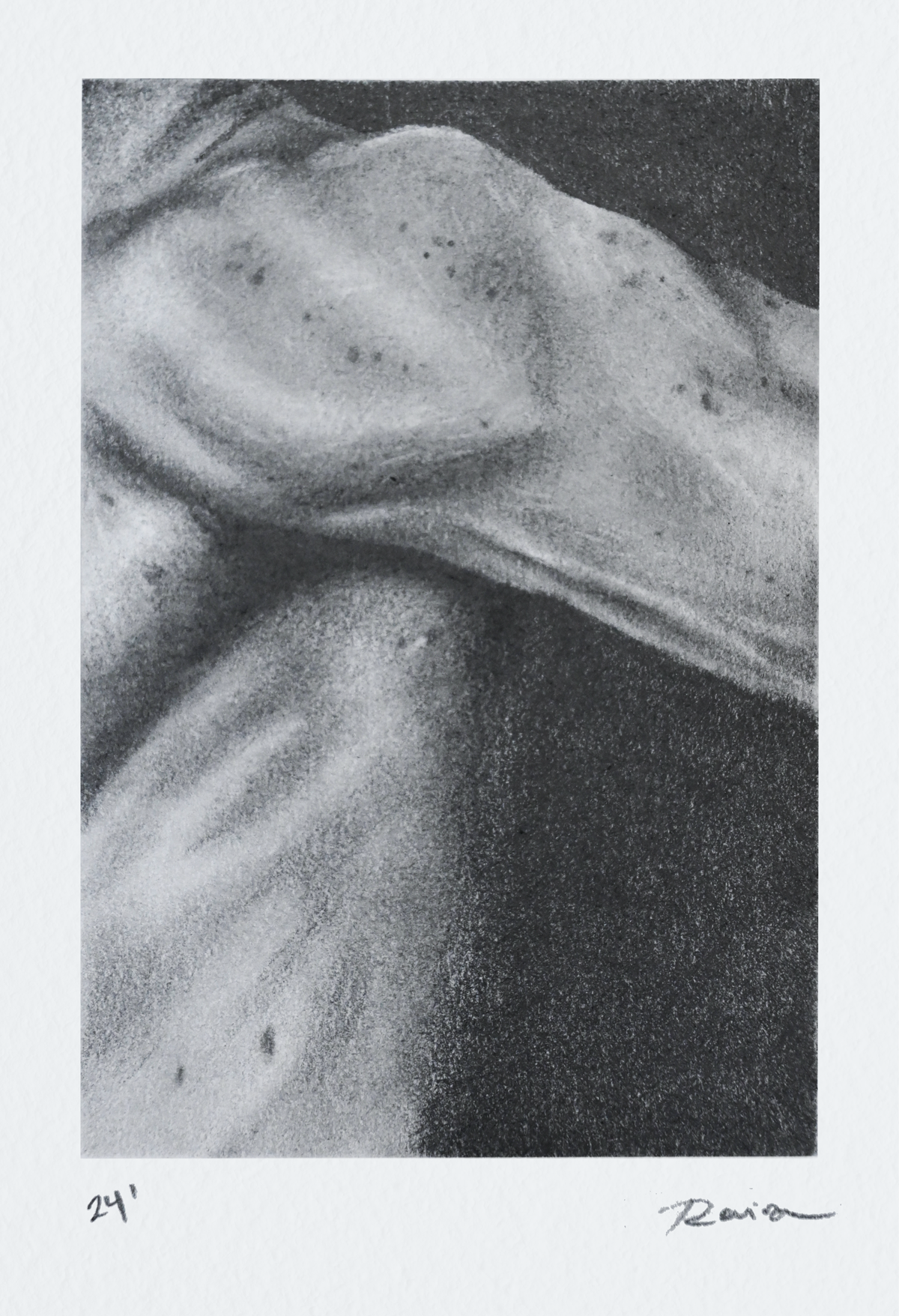 20240422-Brazo.png