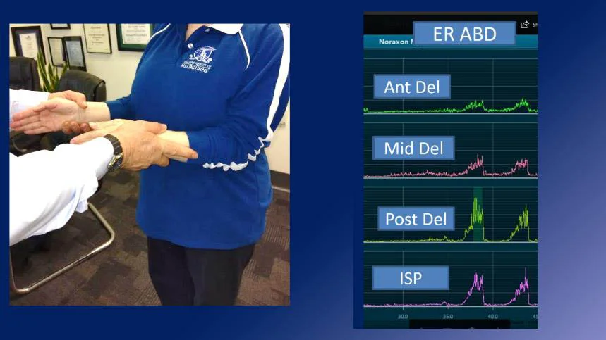 Apparent good ER power - but Middle deltoid recruited by subtle shoulder abduction adding to strength