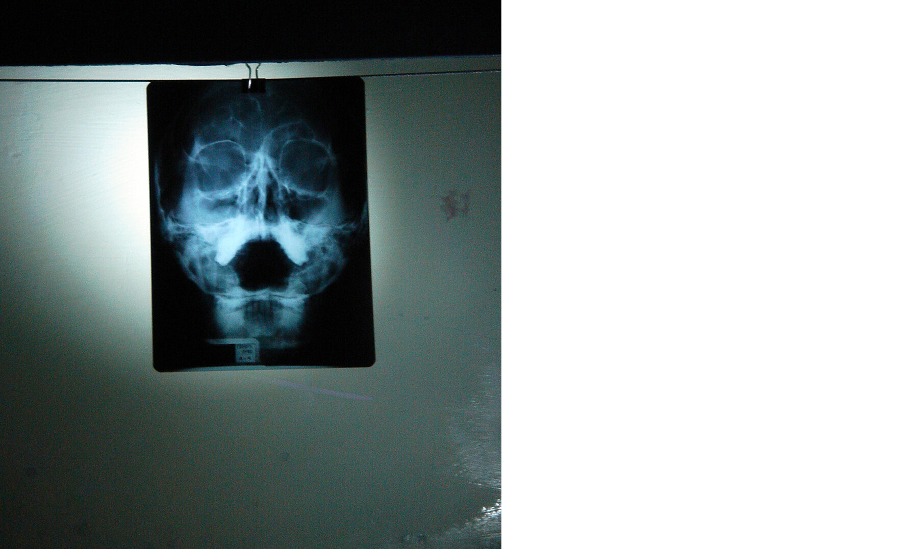   No Laughing matter (2007) Loïc Martin   Radiography, phosphorescent painting. Variable size installation (48,8 x 49,6 x 11,6 inches / 124 x 126 x 29,5 cm) 