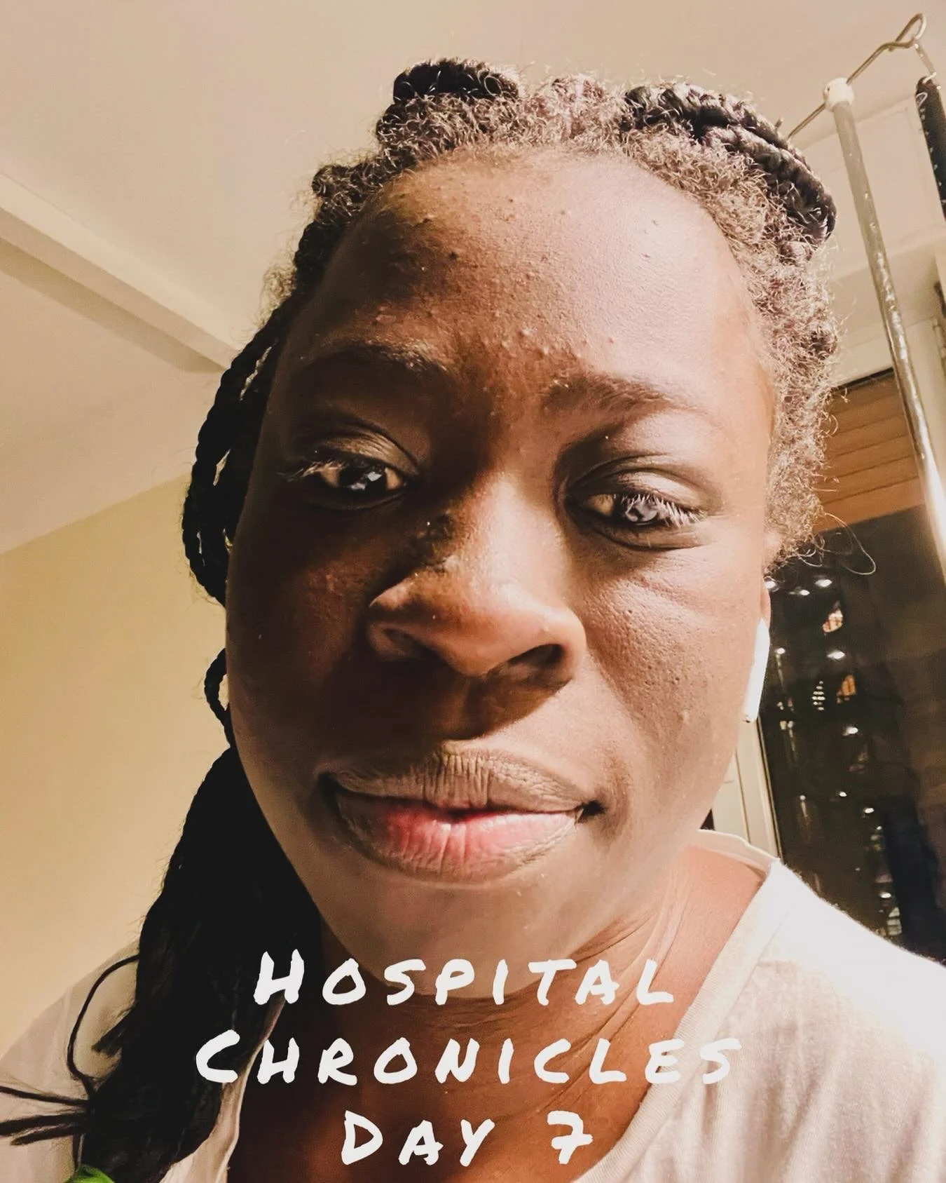 Hospital Chronicles Day 7. It was a better day today. After the rainfall comes the sunshine ☀️ today we talk about healthcare professional and their lack of compassion sometimes. But for every bad apple there is always its good counterpart. So thank 