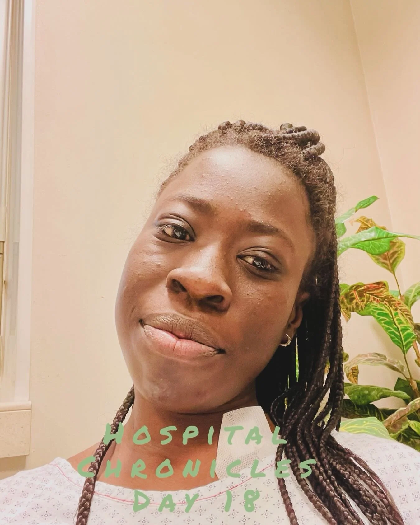 Sorry for the absence. I had 2 operations: one to remove the tube in the stomach and one to put a new one in the neck. I&rsquo;m still recovering and God with me. It&rsquo;s not easy but I&rsquo;m doing it through His grace. Amen 🙏🏿
