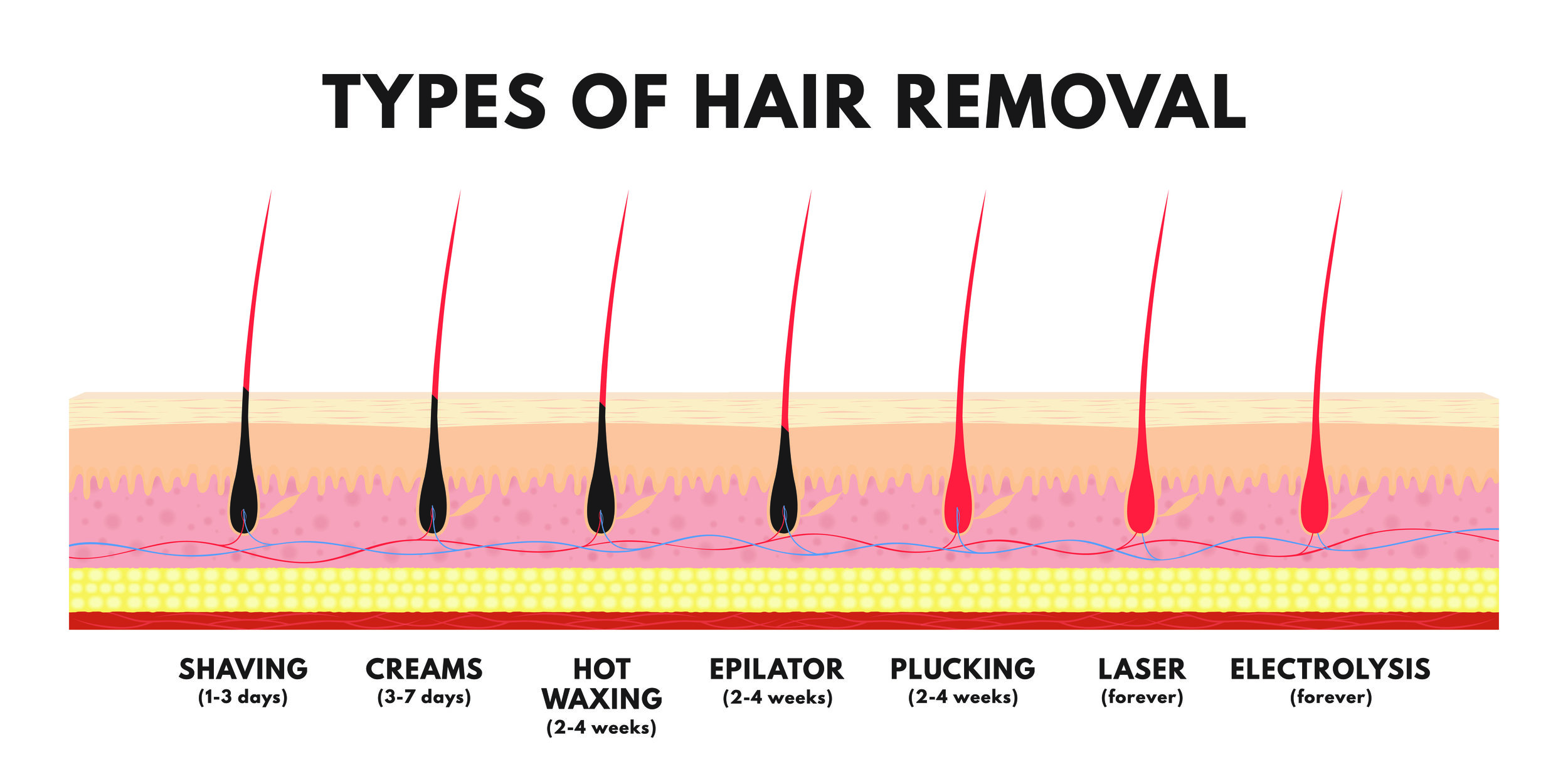 Get Your Electrolysis Hair Removal Facts Straight! | Arborcrest Electrolysis