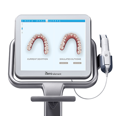 WHAT IS AN ITERO SCANNER?