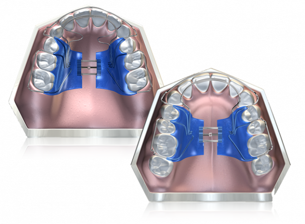 WHAT IS BIOBLOC-ORTHOTROPICS?
