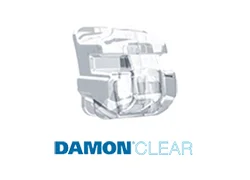 braces_damon_clear.jpg