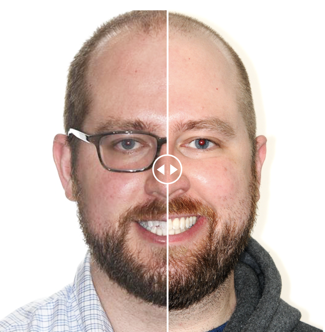 An Incredible Before &amp; After In Just 12 Months