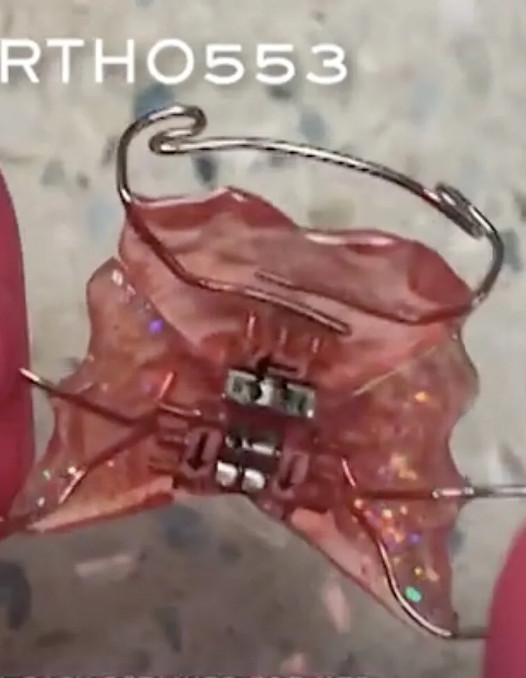 Dr. Salzer Explains Why Custom Made Retainers Matter