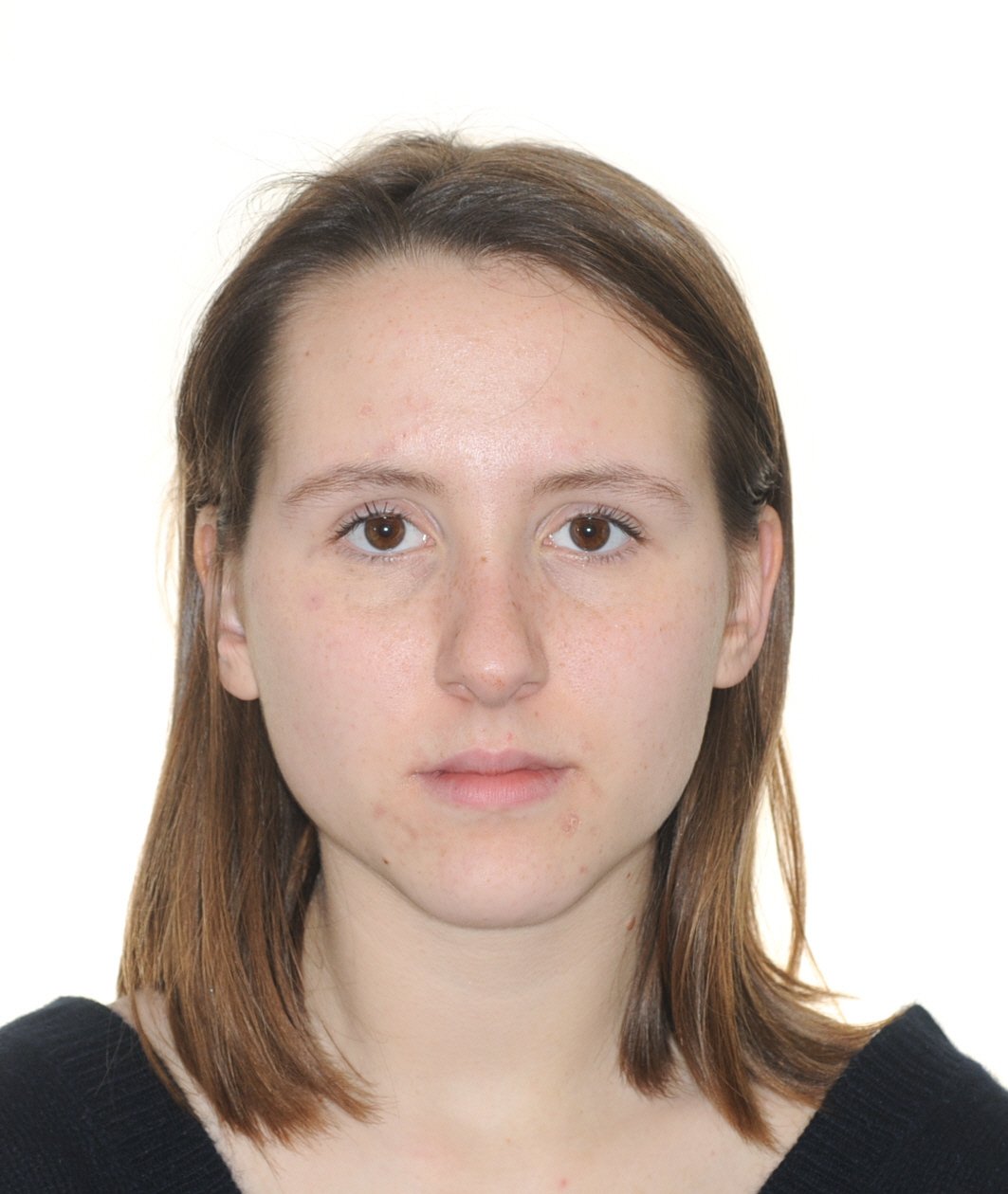 Class III NonSurgrey Best NYC Orthodontist 6 jpeg.jpeg