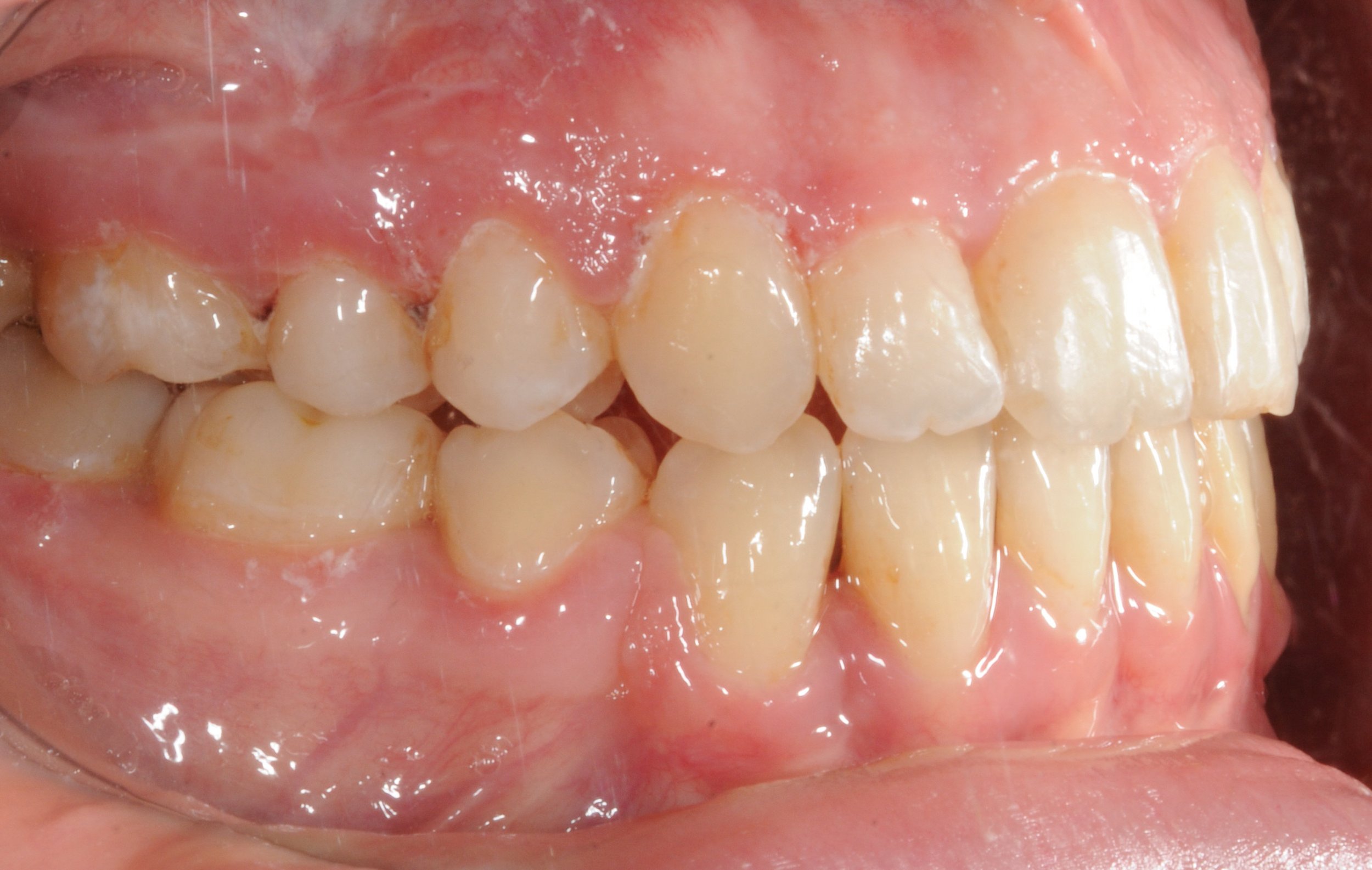 NYC Best Orthodontist 1​9.jpeg