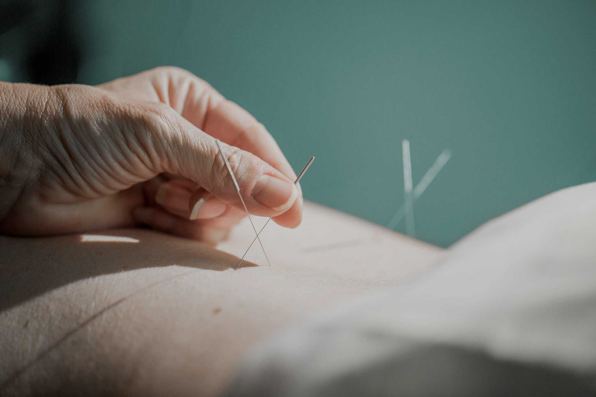 Acupuncture-Cross.jpg