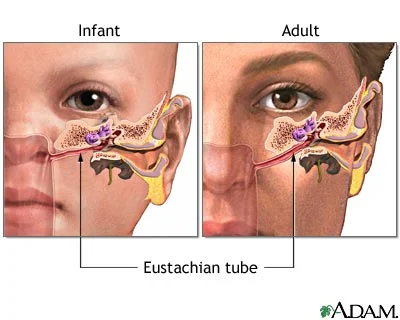 Image from MedLine Plus
