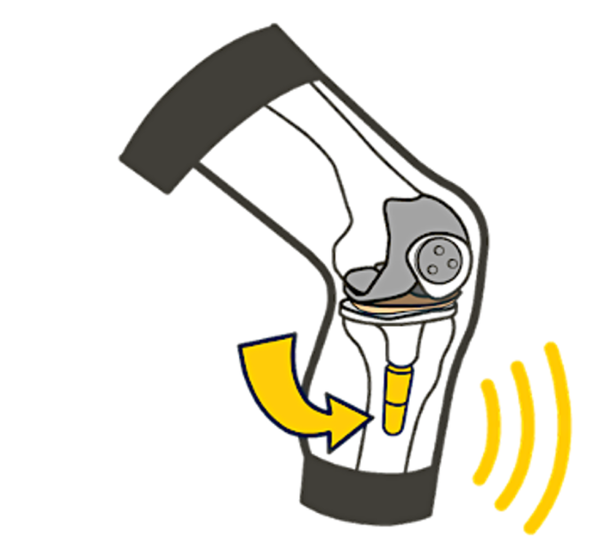 The Knees Are Talking