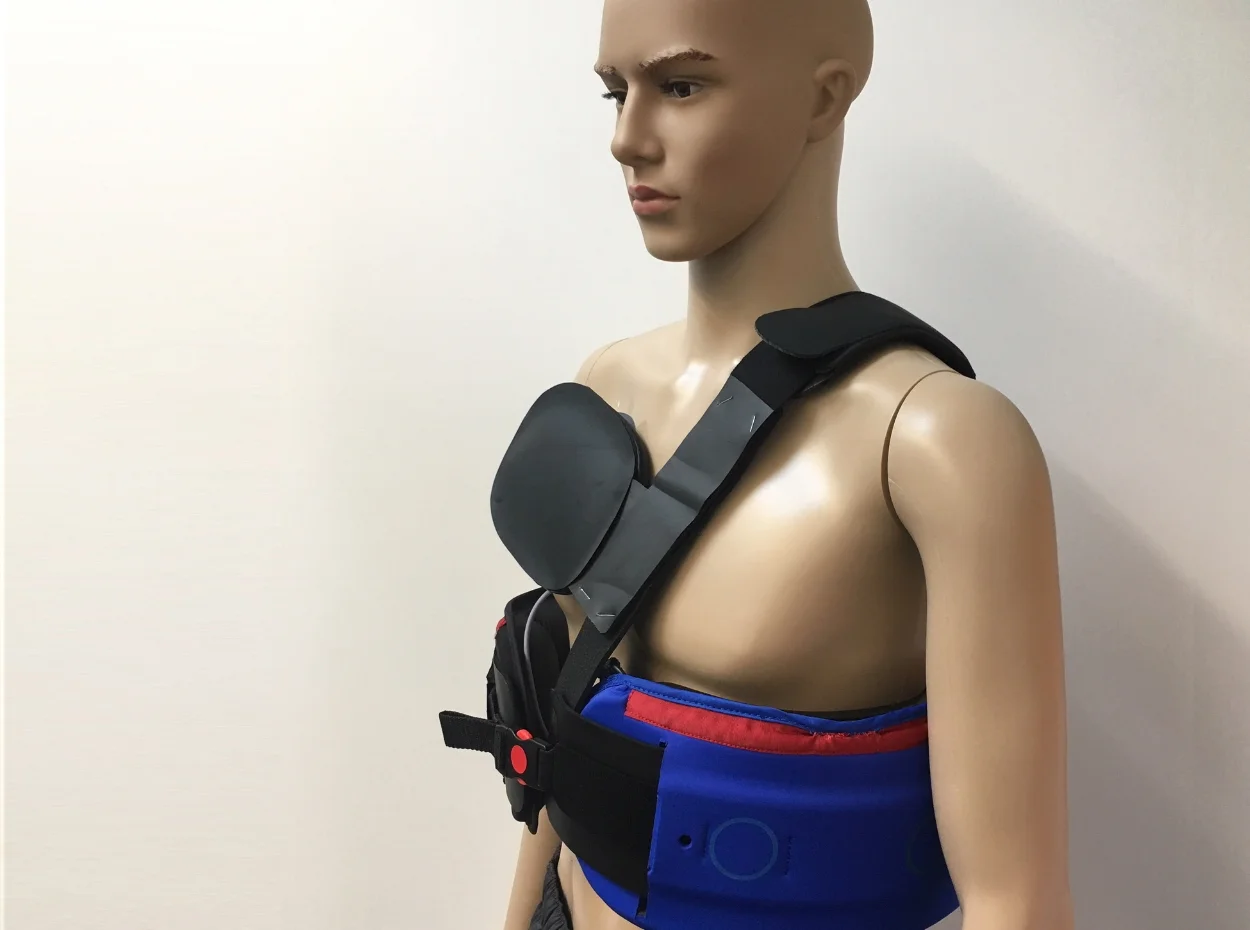  The final mockup of the chosen configuration established the foundation for the current design. Following the completion of the recent IDE clinical trial, the collected data has provided valuable insights into the efficacy of the Placement Accessory