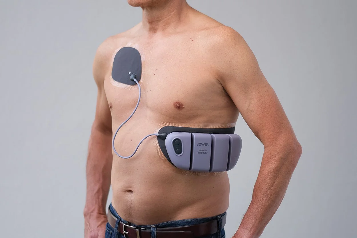  The anterior-lateral placement of the device is strategically designed to allow patients to visually check both patches in a mirror. This positioning also enables the Jewel to function as a one-size-fits-all device for individuals within a specific 