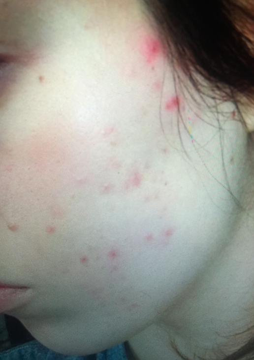 Heal-Yourself-Skin_4.png