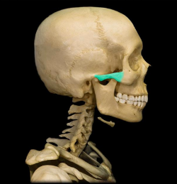 zygomatic-arch.png