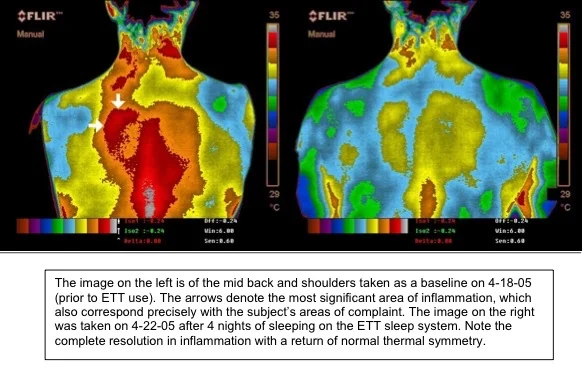 earthing-inflammation1.jpg