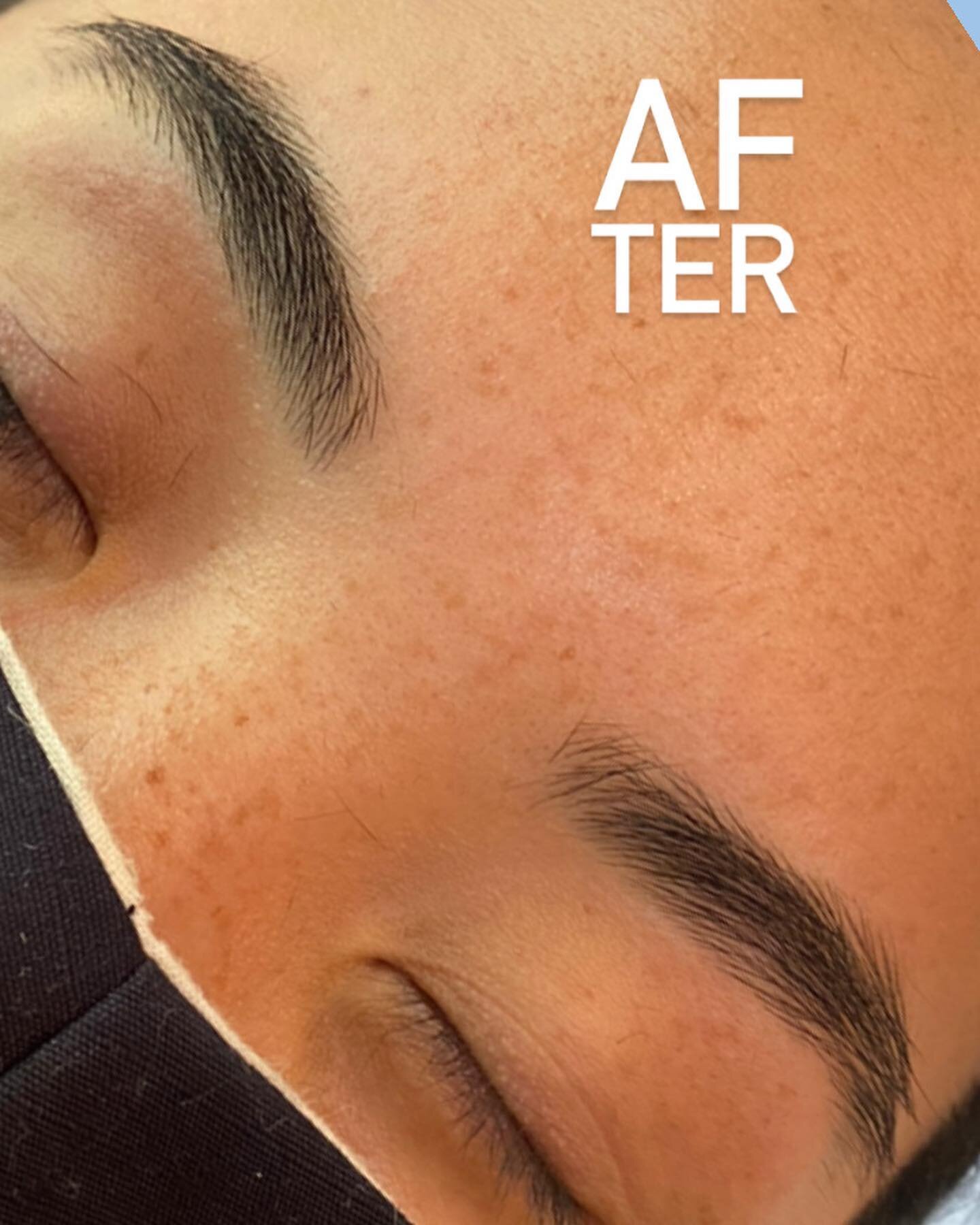 Covid Silver lining? Clients who committed to leaving their brows to reset over the past few months. The result? The brows we&rsquo;ve been aiming for 😍