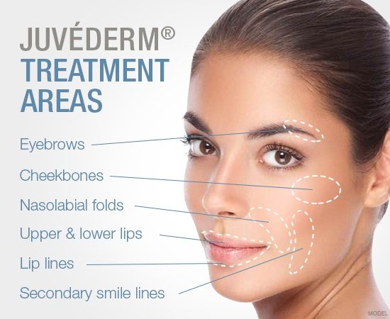 CWS-Juvederm-graphic.jpg